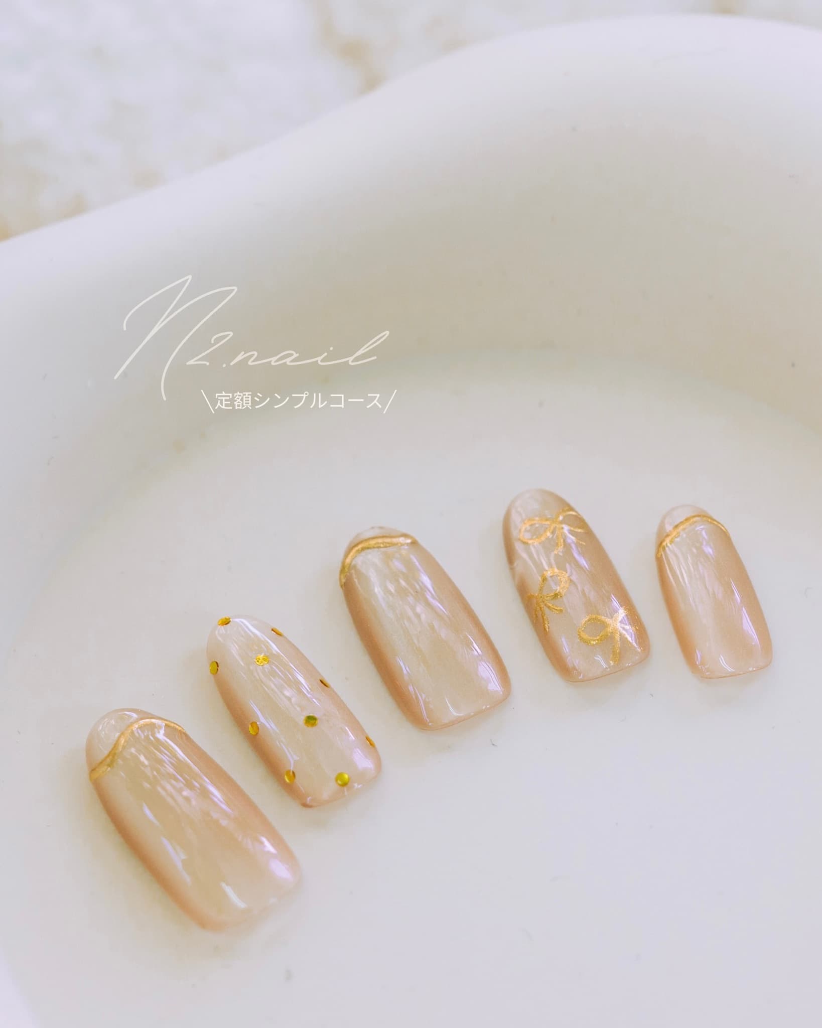 N2 nail STANDARD design 1